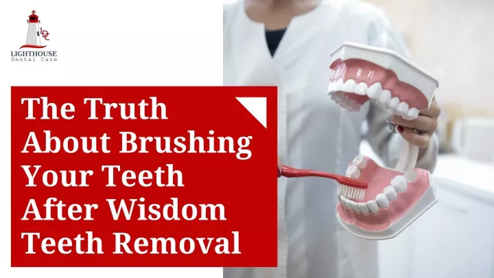 How to brush your teeth after wisdom teeth removal